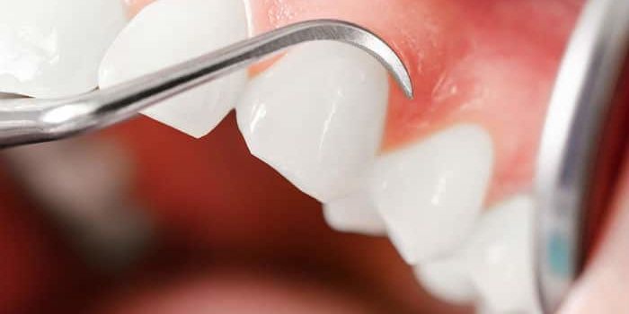 periodoncia-clinica dental barcelona periodoncia-clinica dental barcelona