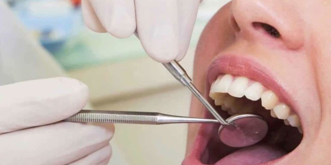 puede-haber-dolor-despues-de-un-empaste clinica dental barcelona