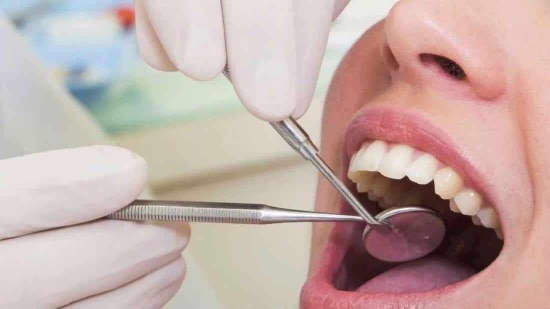 puede-haber-dolor-despues-de-un-empaste clinica dental barcelona