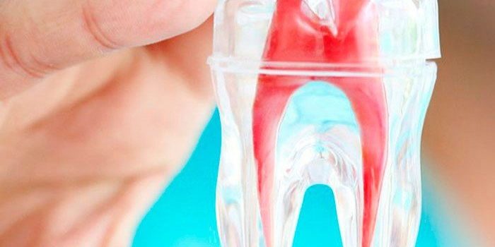 endodoncia-birradicular barcelona