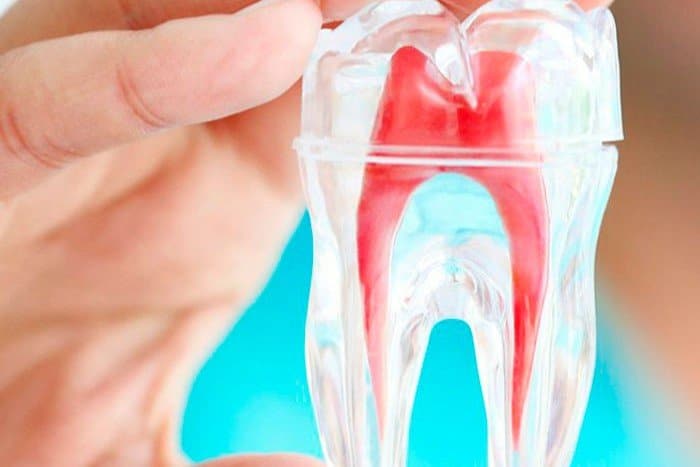 endodoncia-birradicular barcelona