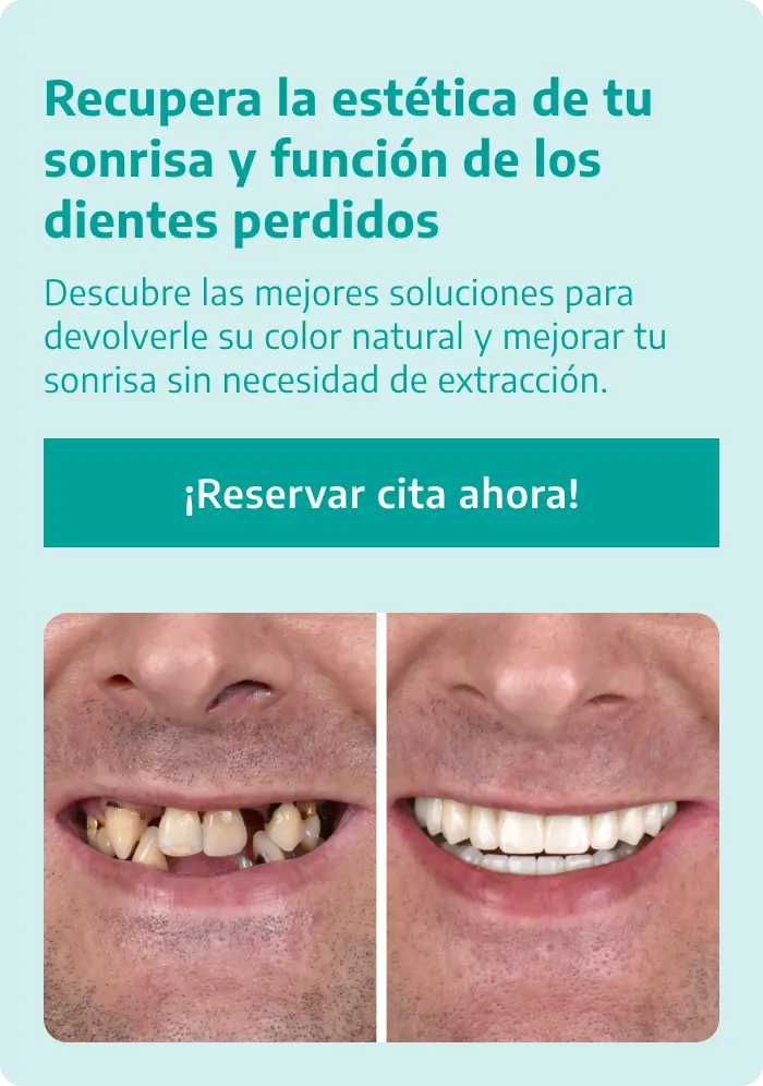 Banner Mobile
