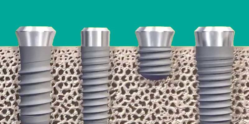 implantes-partes-straumann-roxolid-clinica-dental-puyuelo-barcelona