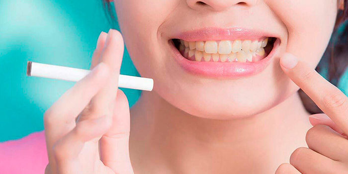 dientes-amarillos-por-tabaco-puyuelo