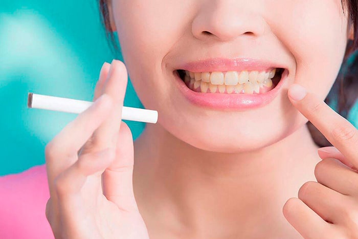 dientes-amarillos-por-tabaco-puyuelo