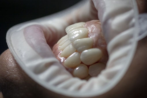 fundas-dentales