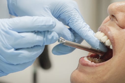 prótesis-e-implantes-dentales