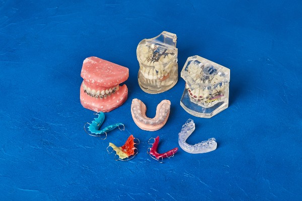 overbite solutions