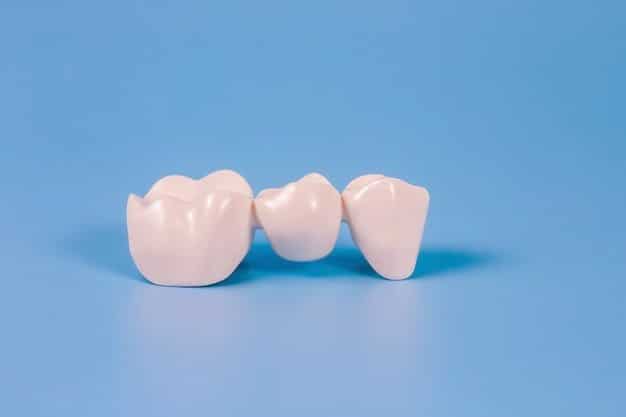 puente dental fijo