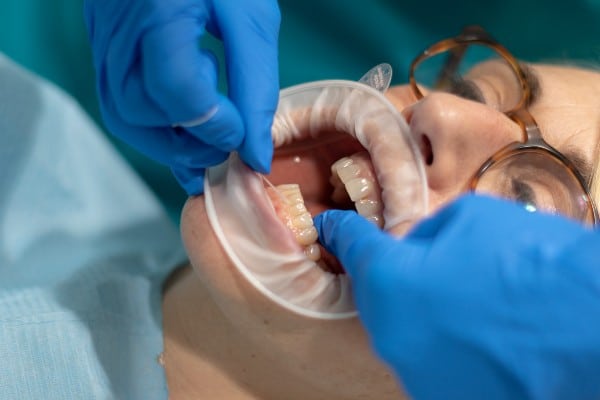 higienista dental que realiza