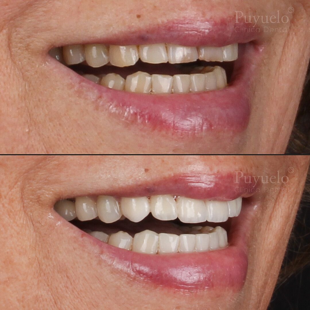 antes-despues-caso-TG-01