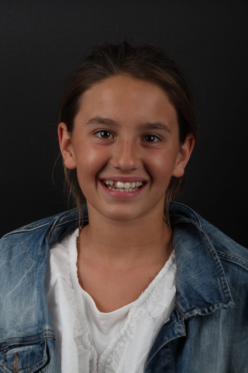 ortodoncia lola antes
