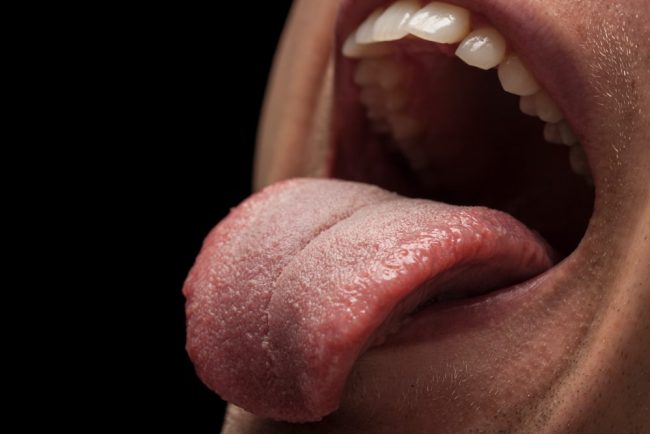 granos en la lengua