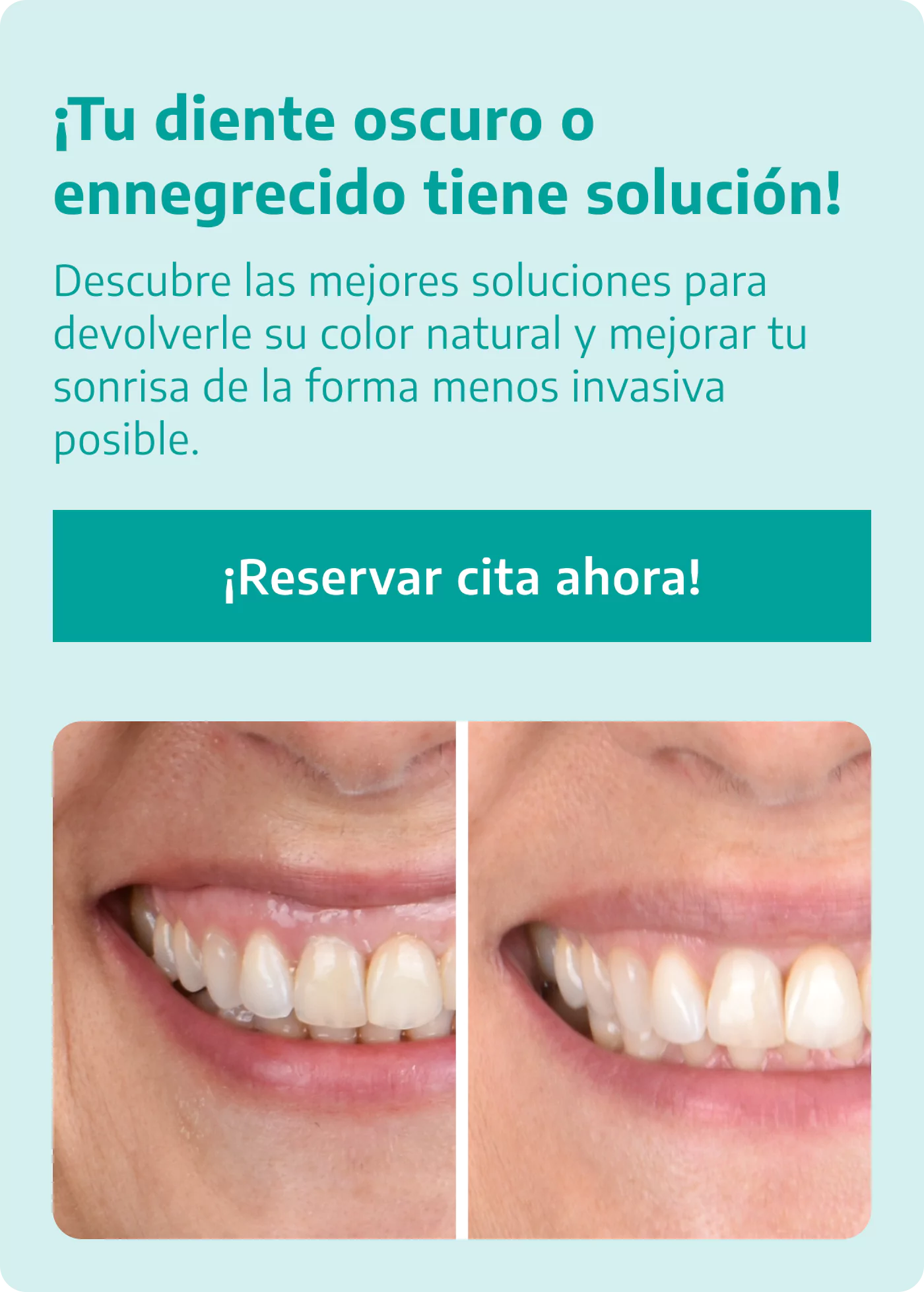 Banner Mobile